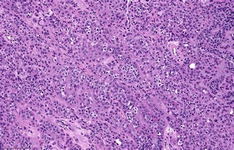webpathology|pathology images online.